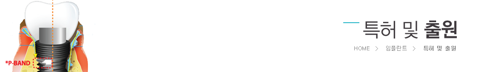 Ư�� �� ���