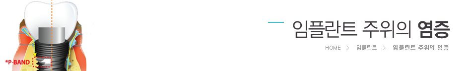 ���ö�Ʈ ������ ����