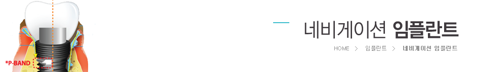 �׺���̼����ö�Ʈ