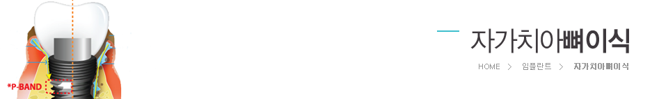 �ڰ�ġ�ƻ��̽�